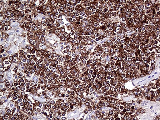 CD79B / CD79 Beta Antibody (clone OTI9H8)