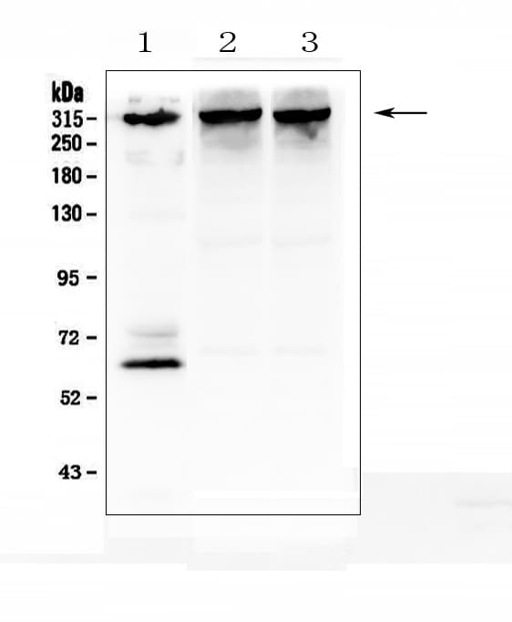 Polyclonal Rabbit anti-Human ITPR1 / IP3 Receptor Type 1 Antibody (aa2411-2758, IHC, WB)