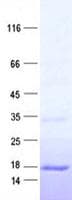 Human FAM69C Protein (Recombinant His, N-Terminal)