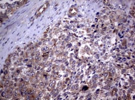 PIK3C2A Antibody (aa230-560, clone OTI3H2)