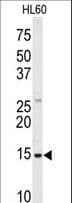 SNRPD1 / SMD1 Antibody (aa46-78)