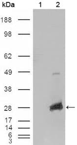 IHC-plus™ CRYAB / Alpha B Crystallin Antibody (clone 1D11C6E6)