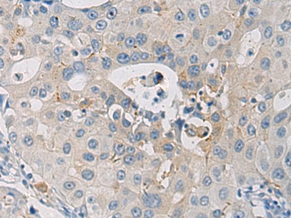 Polyclonal Rabbit anti-Human WFDC3 Antibody (IHC)