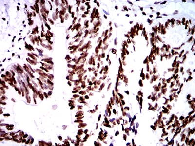 ZFP91 Antibody (clone 8C3D5)