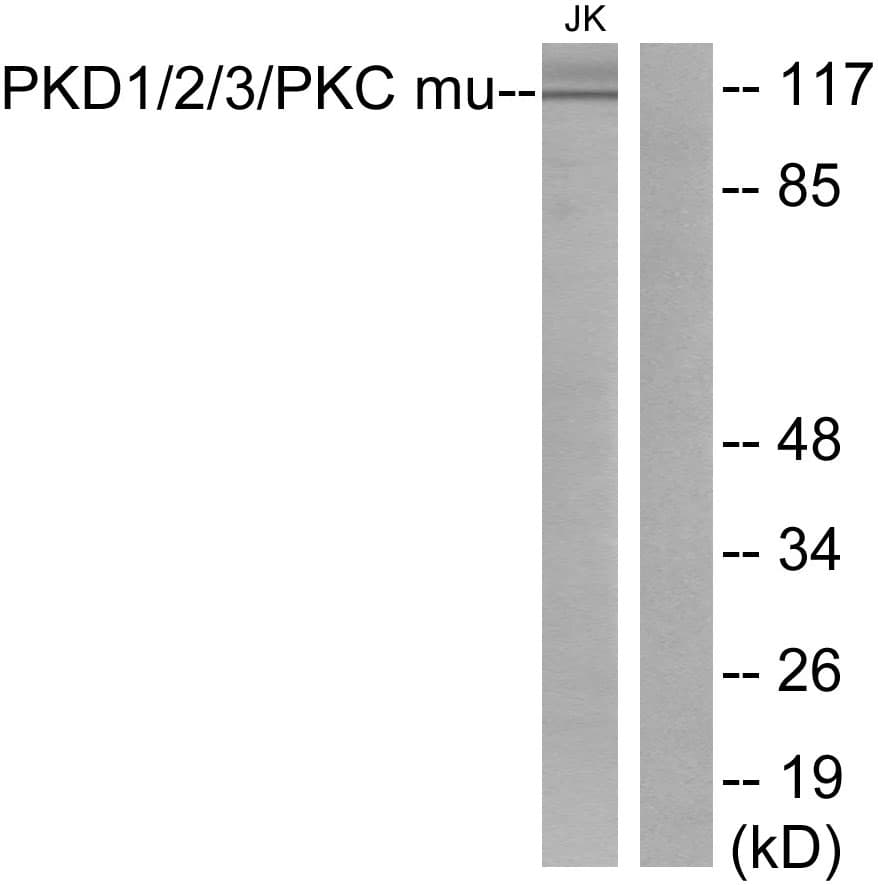 PRKD1 / PKC Mu Antibody (aa706-755)
