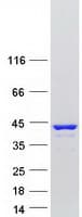 Human TNNT2 / CTNT Protein (Recombinant Myc-DDK (Flag))