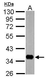 nrv1 Antibody (N-Terminus)