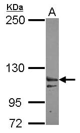 XPO6 Antibody