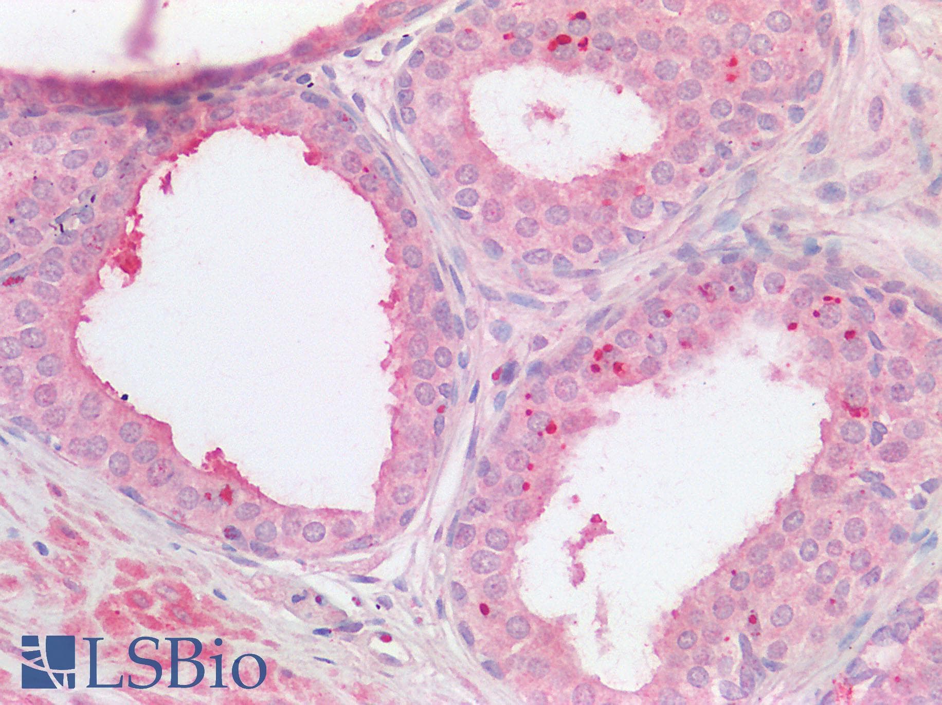IHC-plus™ Polyclonal Rabbit anti-Human TMPRSS2 / Epitheliasin Antibody (IHC)