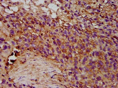 Polyclonal Rabbit anti-Human Eosinophil Peroxidase / EPX Antibody (IHC)
