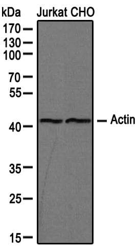 PathPlus™ Actin Antibody (clone mAbGEa)