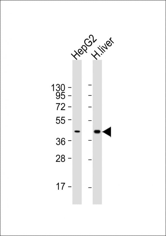Monoclonal Mouse anti-Human AGXT / SPT Antibody (clone 1739CT804.82.83.1, WB)