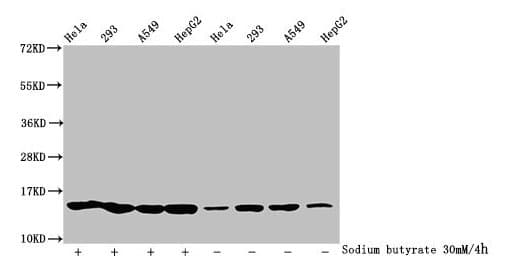 HIST1H2BN Antibody