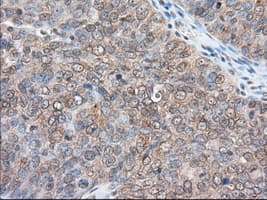 IHC-plus™ RANGAP1 Antibody (clone 1B4)