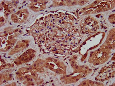 Polyclonal Rabbit anti-Human GINS1 / PSF1 Antibody (IHC)