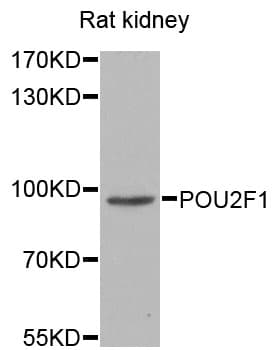 Polyclonal Rabbit anti-Human POU2F1 / OCT1 Antibody (IHC, WB)