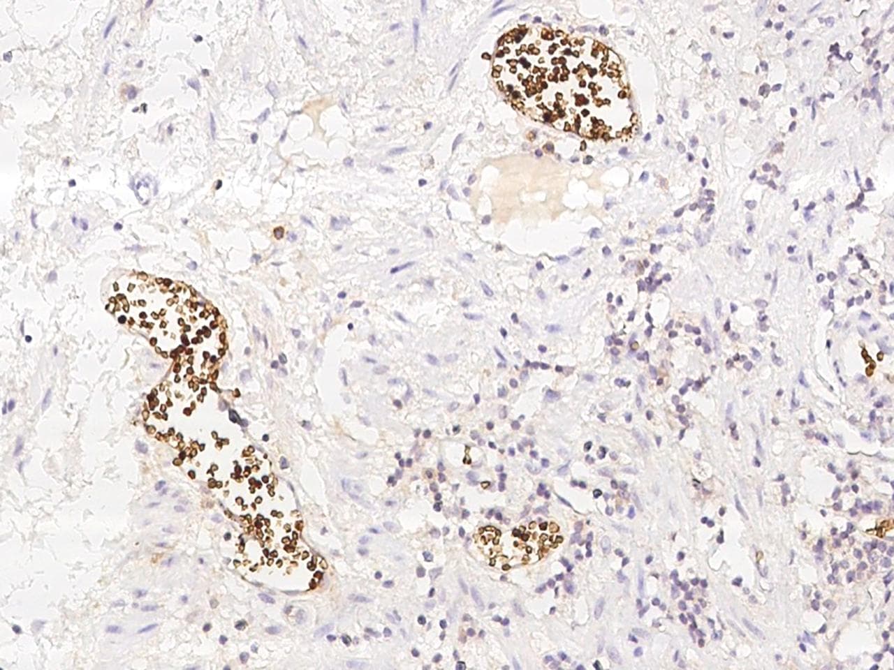 Band 4.1 / EPB41 Antibody
