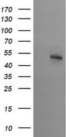 STK38L / NDR2 Antibody (clone OTI3E10)