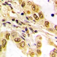 ATF2 Antibody (Internal)