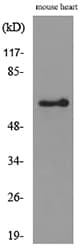 Polyclonal Rabbit anti-Human ANGPTL1 + ANGPTL2 Antibody (WB)