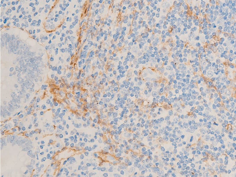 ACTA2 / Smooth Muscle Actin Antibody