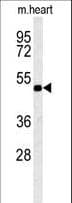 KCNV1 / Kv8.1 Antibody (aa137-166)