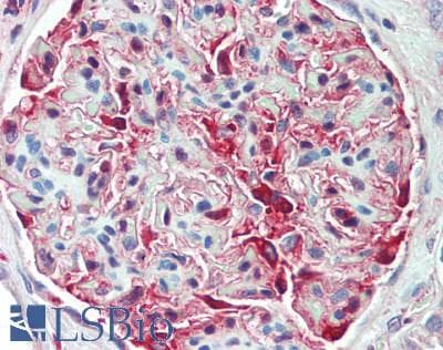 Polyclonal Rabbit anti-Human ARRB1 + ARRB2 Antibody (IHC, WB)