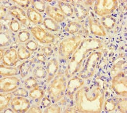Polyclonal Rabbit anti-Human B4GALT5 Antibody