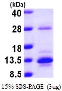 Human S100A10 Protein (Recombinant His)