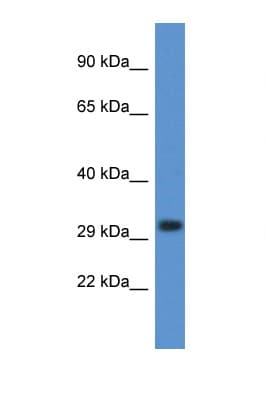 LSD / DNASE1L3 Antibody (C-Terminus)