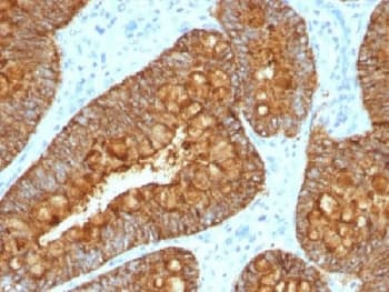 MAML3 / CAGH3 Antibody (clone MAML3/1303)