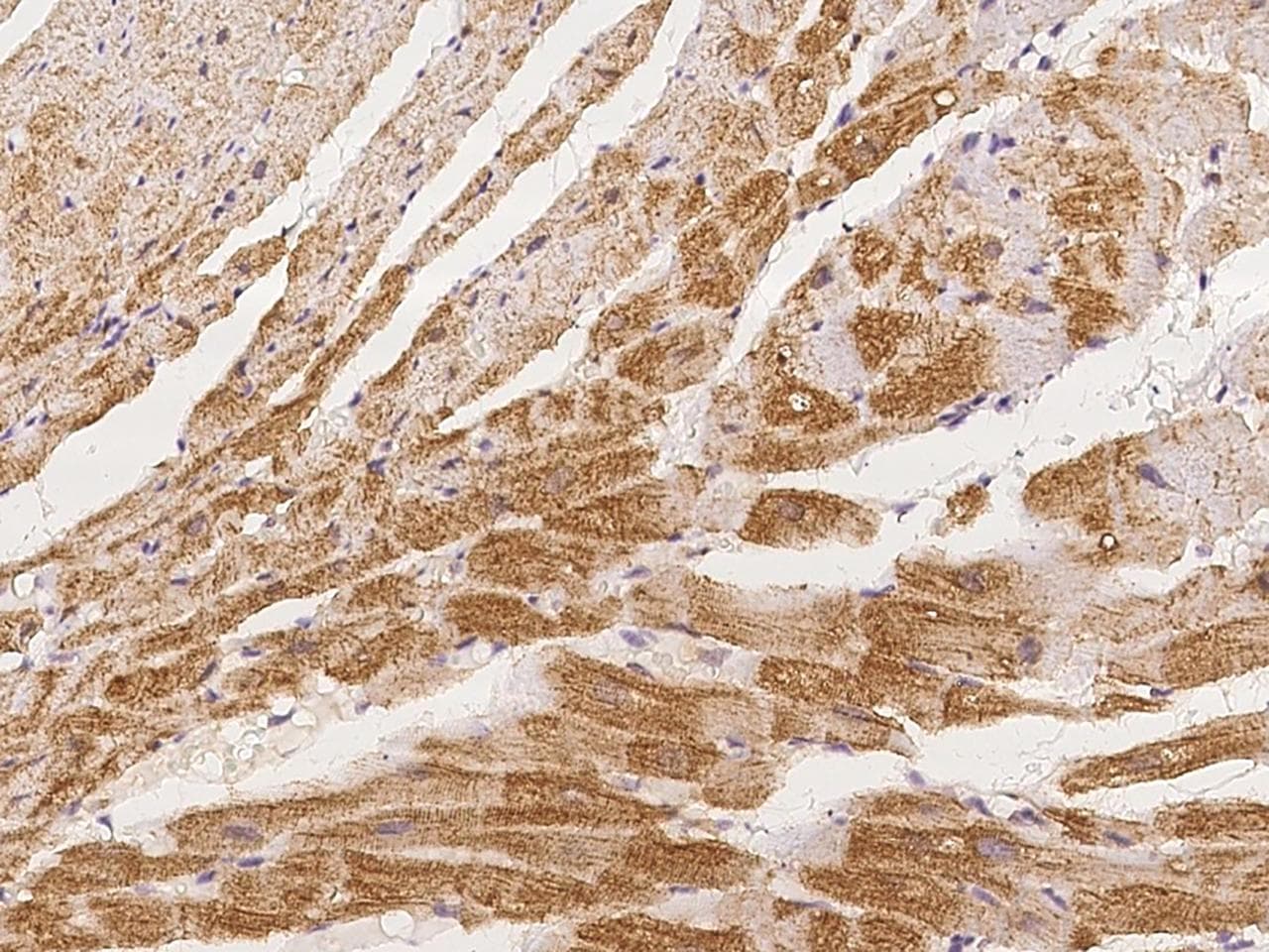ZNF175 Antibody