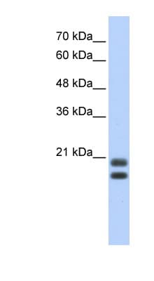 SRGN / Serglycin Antibody (aa71-120)