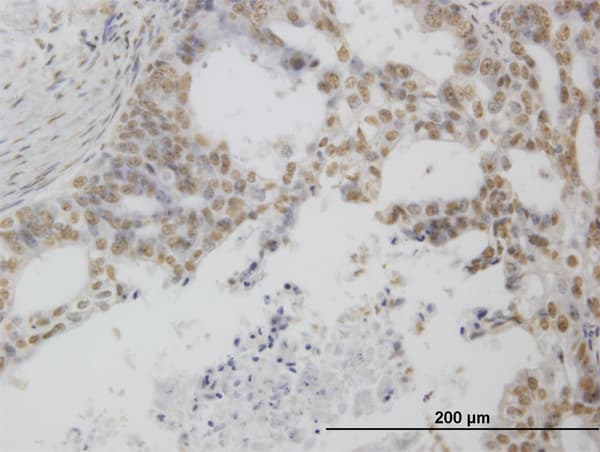 POLR1C / RPA39 Antibody (clone M1)