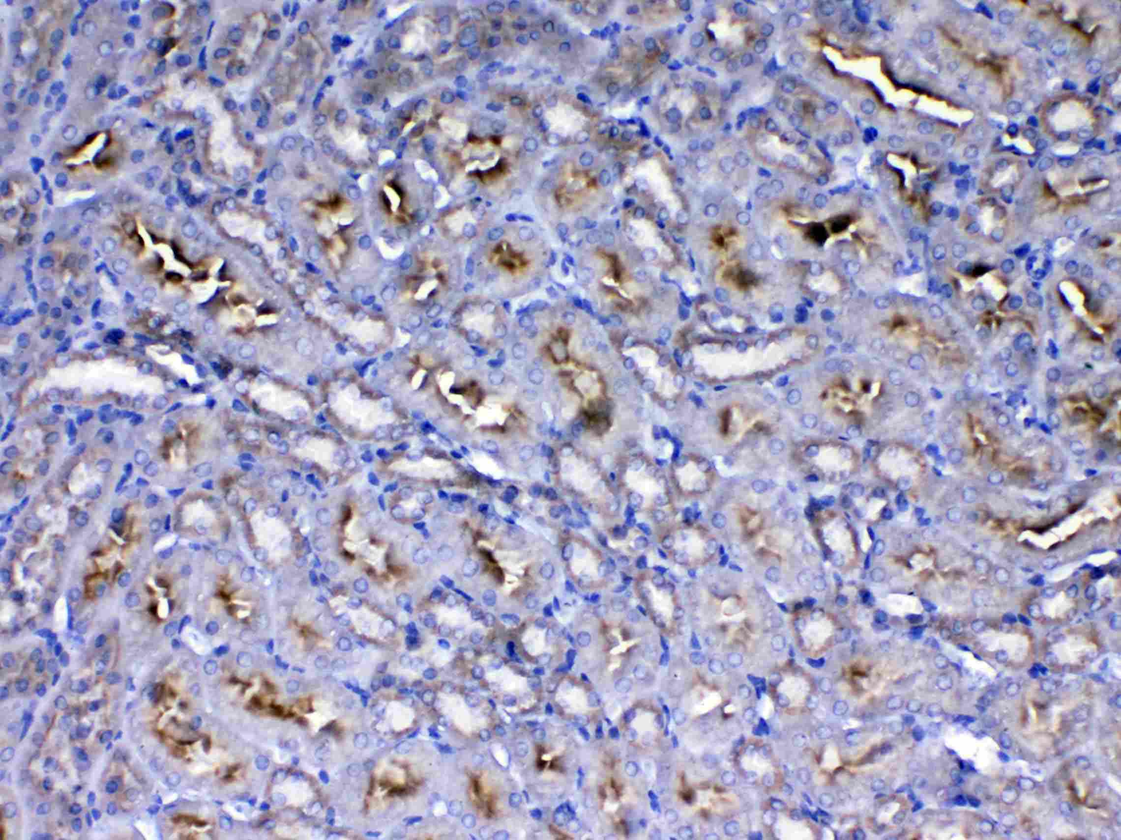 IGF1R / IGF1 Receptor Antibody