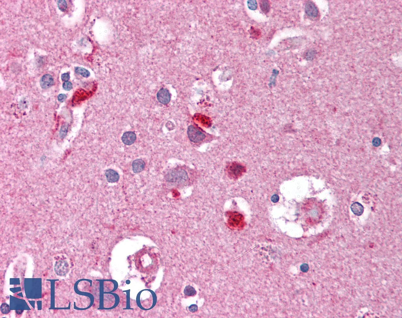 IHC-plus™ Monoclonal Mouse anti-Human FEN1 Antibody (clone 4E7, aa1-380, IHC, WB)