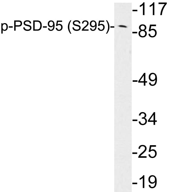 DLG4 / PSD95 Antibody (phospho-Ser295)