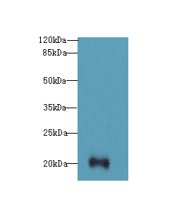 Polyclonal Rabbit anti-Human TTC9C Antibody (IHC, WB)