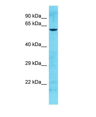 HHLA1 Antibody (N-Terminus, HRP)