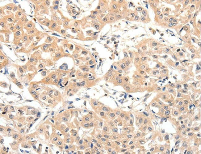 SLC27A1 / FATP Antibody