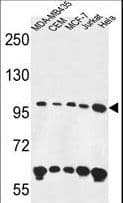 Polyclonal Rabbit anti-Human ANKFY1 Antibody (aa436-465, IHC, WB)