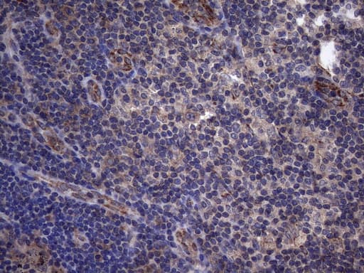 SUOX / Sulfite Oxidase Antibody (aa320-545, clone OTI1A12)