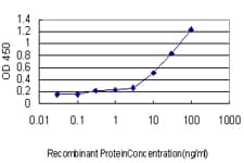 IHC-plus™ MEF2A / MEF2 Antibody (clone 1A10)