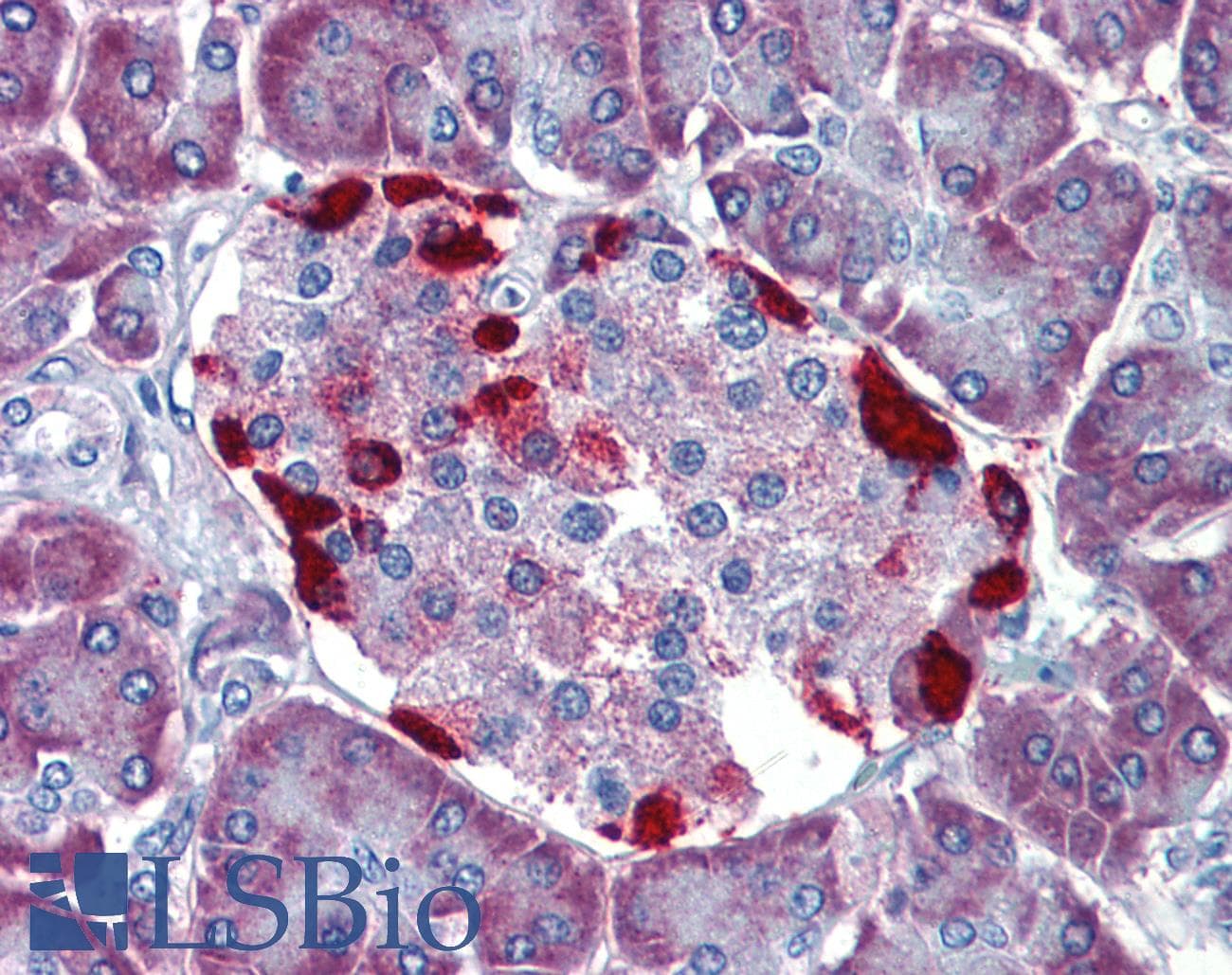 IHC-plus™ LRRN4 / C20orf75 Antibody (N-Terminus)