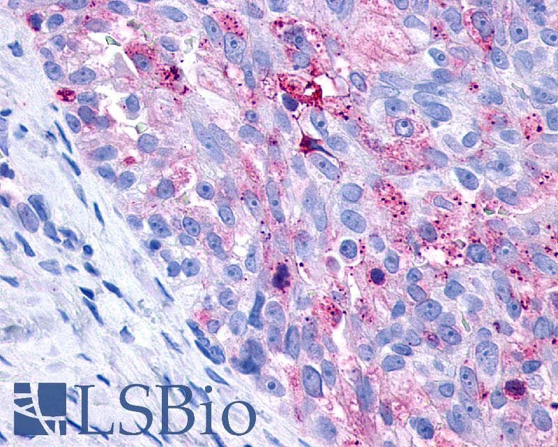 IHC-plus™ Polyclonal Rabbit anti-Human P2Y10 / P2RY10 Antibody (C-Terminus, IHC)