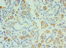 CST4 / Cystatin S Antibody (aa21-141)