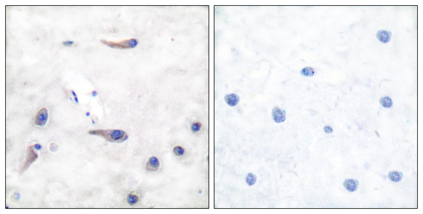 MARCKS Antibody (p162)
