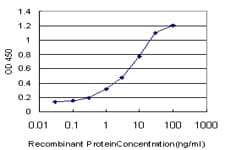 Monoclonal Mouse anti-Human C1D Antibody (clone 6H2, IF, WB)