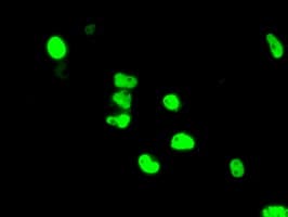 Monoclonal Mouse anti-Human ARNT / HIF-1-Beta Antibody (clone OTI1F4, IHC, IF, WB)