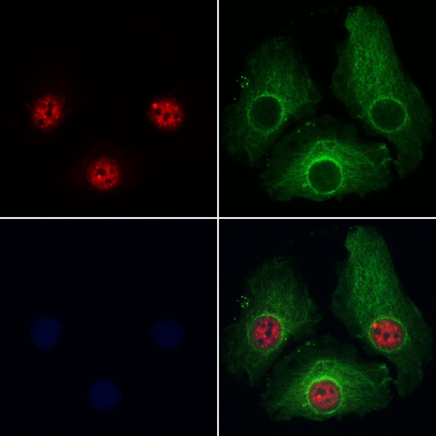 PRPF4 Antibody